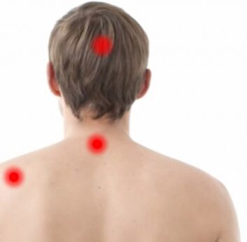 Κοπάδι οστεοχονδρισμού